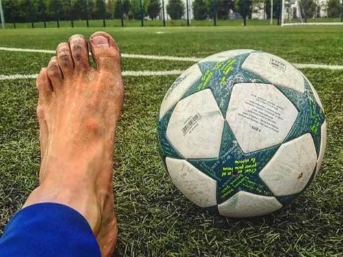 Tìm hiểu 5 nguyên nhân và cách xử lý khi mang giày đá bóng bị tím ngón