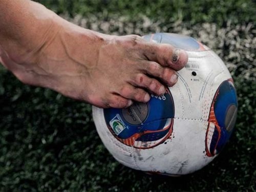 Mang giày đá bóng bị đau lòng bàn chân | Nguyên nhân và cách khắc phục