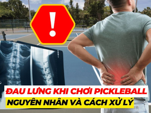 Đau lưng khi chơi pickleball: Nguyên nhân và cách phòng tránh