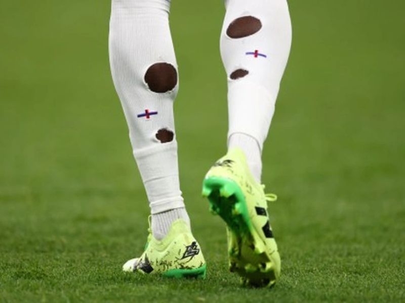 Xu hướng tất thủng lỗ trong bóng đá nhận được nhiều ý kiến khác nhau