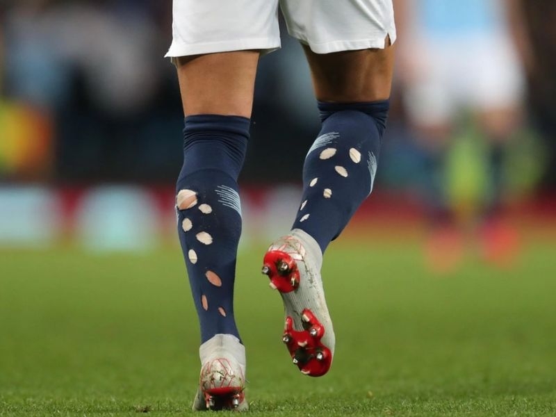 Xu hướng tất thủng lỗ trong bóng đá nhận được nhiều ý kiến khác nhau