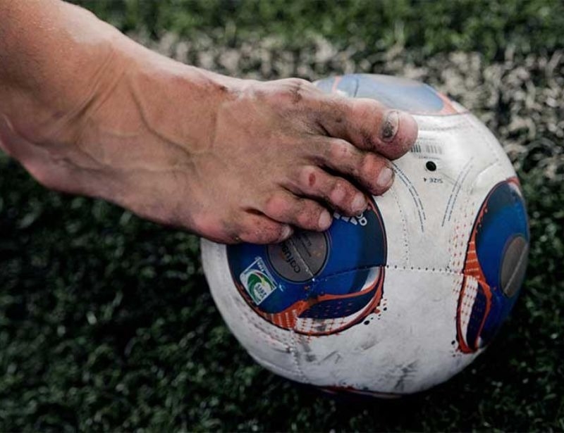 Mang giày đá bóng bị đau lòng bàn chân