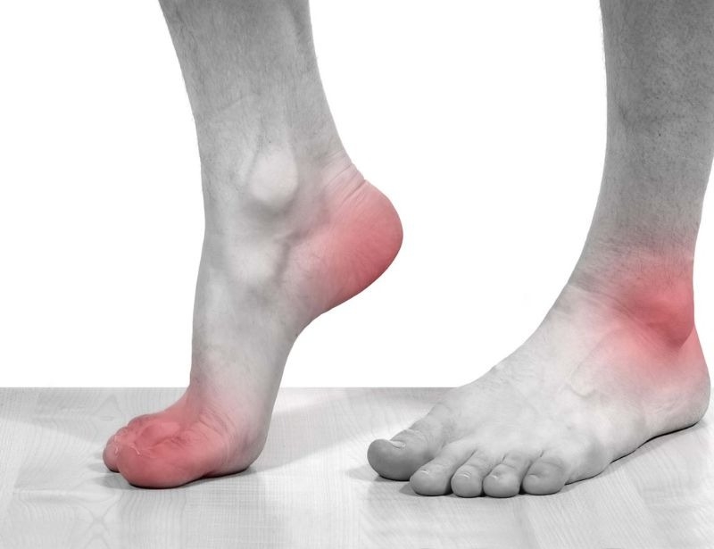 Giày đá bóng bị dư mũi để lại những vấn đề gì?