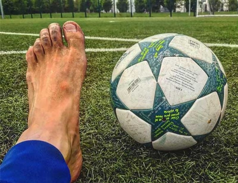 Do mang giày quá lâu